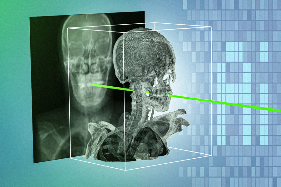 MIT Researchers Develop Patient-Specific AI for More Precise Surgical Navigation